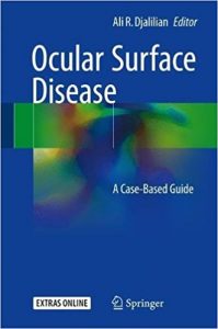 free-pdf-download-Ocular Surface Disease: A Case-Based Guide 1st ed. 2018 Edition