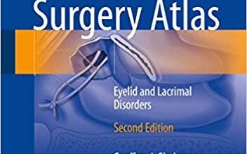 free-pdf-download-Oculoplastic Surgery Atlas: Eyelid and Lacrimal Disorders 2nd Edition