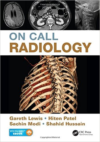 free-pdf-download-On Call Radiology Pap/Psc Edition