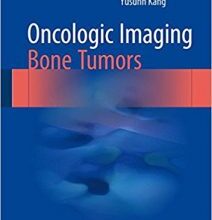 free-pdf-download-Oncologic Imaging: Bone Tumors 1st ed