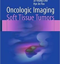 free-pdf-download-Oncologic Imaging: Soft Tissue Tumors 1st ed. 2017 Edition