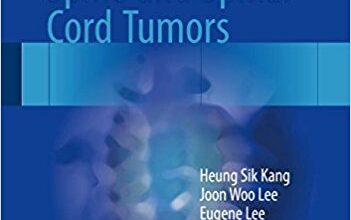 free-pdf-download-Oncologic Imaging: Spine and Spinal Cord Tumors 1st ed. 2017 Edition