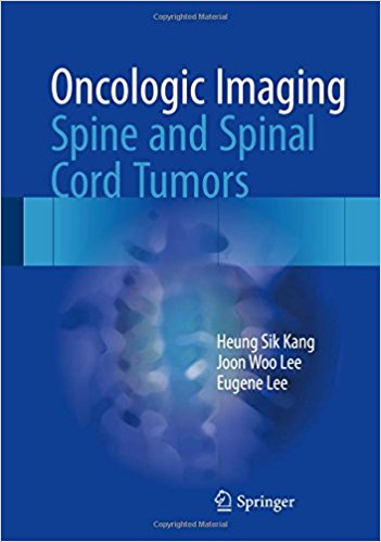 free-pdf-download-Oncologic Imaging: Spine and Spinal Cord Tumors 1st ed. 2017 Edition