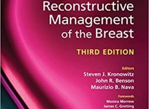 free-pdf-download-Oncoplastic and Reconstructive Management of the Breast