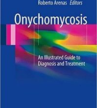 free-pdf-download-Onychomycosis: An Illustrated Guide to Diagnosis and Treatment 1st ed