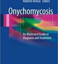 free-pdf-download-Onychomycosis: An Illustrated Guide to Diagnosis and Treatment 1st ed. 2017 Edition