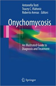 free-pdf-download-Onychomycosis: An Illustrated Guide to Diagnosis and Treatment 1st ed. 2017 Edition