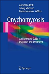 free-pdf-download-Onychomycosis: An Illustrated Guide to Diagnosis and Treatment 1st ed