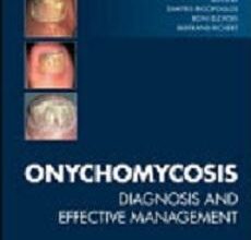 free-pdf-download-Onychomycosis: Diagnosis and Effective Management