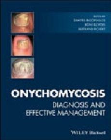 free-pdf-download-Onychomycosis: Diagnosis and Effective Management