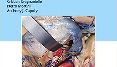 free-pdf-download-Operative Cranial Neurosurgical Anatomy 1st Edition