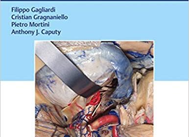 free-pdf-download-Operative Cranial Neurosurgical Anatomy 1st Edition