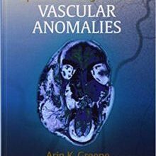 free-pdf-download-Operative Management of Vascular Anomalies 1st Edition