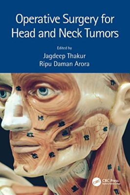 free-pdf-download-Operative Surgery for Head and Neck Tumors