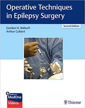 free-pdf-download-Operative Techniques in Epilepsy Surgery 2nd Edition