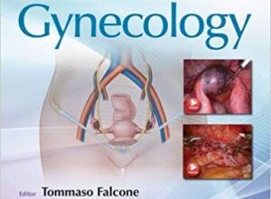 free-pdf-download-Operative Techniques in Gynecologic Surgery: Gynecology: Gynecology 1st Edition