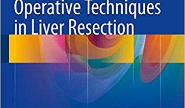 free-pdf-download-Operative Techniques in Liver Resection 1st ed