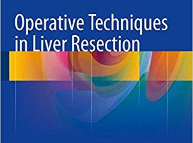 free-pdf-download-Operative Techniques in Liver Resection 1st ed