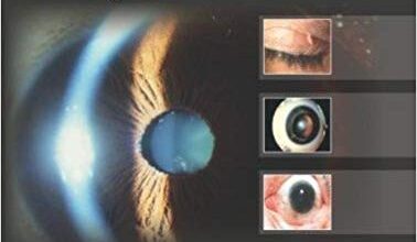 free-pdf-download-Ophthalmic Diagnosis and Treatment 3rd Edition