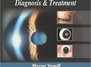 free-pdf-download-Ophthalmic Diagnosis and Treatment 3rd Edition