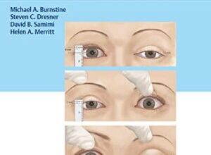 free-pdf-download-Ophthalmic Plastic Surgery of the Upper Face