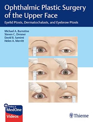 free-pdf-download-Ophthalmic Plastic Surgery of the Upper Face