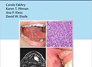 free-pdf-download-Oral Cancer: Evaluation