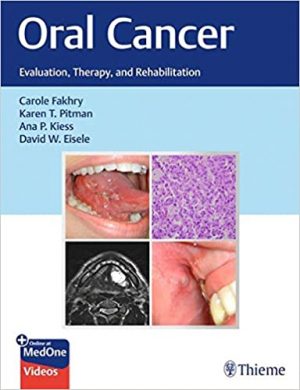 free-pdf-download-Oral Cancer: Evaluation