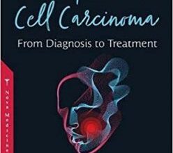 free-pdf-download-Oral Squamous Cell Carcinoma: From Diagnosis to Treatment