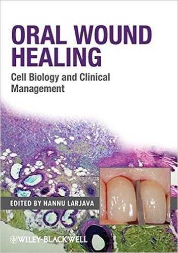 free-pdf-download-Oral Wound Healing: Cell Biology and Clinical Management 1st Edition