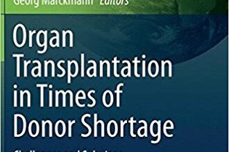 free-pdf-download-Organ Transplantation in Times of Donor Shortage: Challenges and Solutions