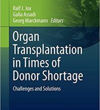 free-pdf-download-Organ Transplantation in Times of Donor Shortage: Challenges and Solutions (International Library of Ethics