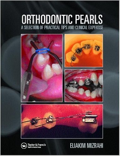 free-pdf-download-Orthodontic Pearls: A Selection of Practical Tips and Clinical Expertise 1st Edition