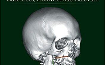 free-pdf-download-Orthognathic Surgery: Principles