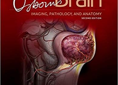 free-pdf-download-Osborn’s Brain 2nd Edition