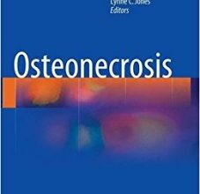 free-pdf-download-Osteonecrosis Softcover reprint of the original 1st ed