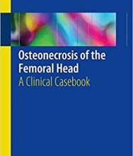 free-pdf-download-Osteonecrosis of the Femoral Head: A Clinical Casebook 1st ed.