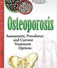 free-pdf-download-Osteoporosis: Assessment