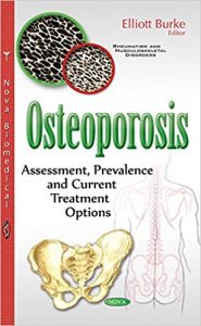 free-pdf-download-Osteoporosis: Assessment