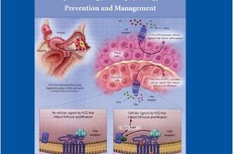 free-pdf-download-Ovarian Hyperstimulation Syndrome: Epidemiology