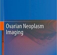 free-pdf-download-Ovarian Neoplasm Imaging