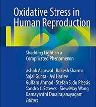 free-pdf-download-Oxidative Stress in Human Reproduction: Shedding Light on a Complicated Phenomenon (Springerbriefs in Reproductive Biology) 1st ed. 2017 Edition