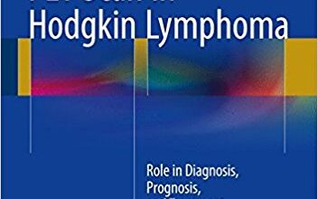 free-pdf-download-PET Scan in Hodgkin Lymphoma: Role in Diagnosis