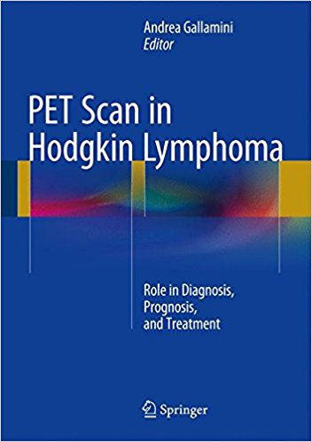 free-pdf-download-PET Scan in Hodgkin Lymphoma: Role in Diagnosis