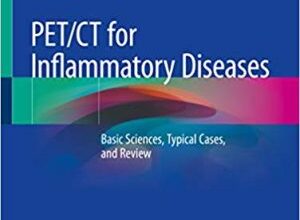 free-pdf-download-PET/CT for Inflammatory Diseases: Basic Sciences