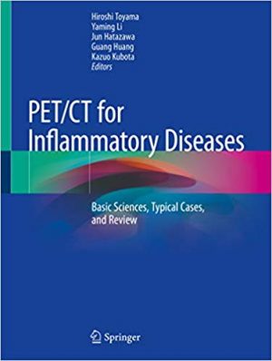 free-pdf-download-PET/CT for Inflammatory Diseases: Basic Sciences