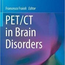 free-pdf-download-PET/CT in Brain Disorders