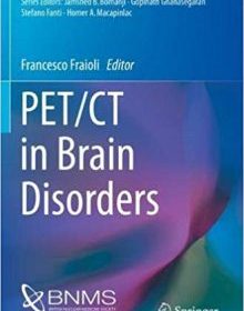 free-pdf-download-PET/CT in Brain Disorders