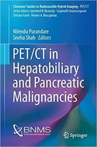 free-pdf-download-PET/CT in Hepatobiliary and Pancreatic Malignancies (Clinicians’ Guides to Radionuclide Hybrid Imaging) 1st ed