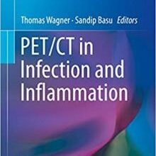 free-pdf-download-PET/CT in Infection and Inflammation